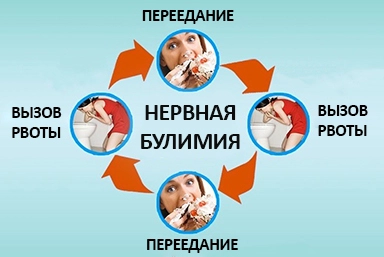 Лечение булимии в Жуковском